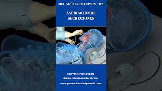 ✔️Procedimiento ASPIRACIÓN de SECRECIONES🩺👩‍⚕️ 👨‍⚕️ [upl. by Zimmermann]