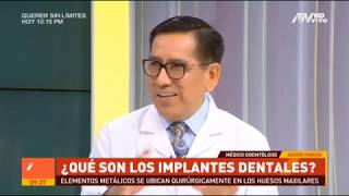 Implantes Dentales en 1 cita [upl. by Aisylla]