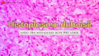 Histoplasma duboisii under the microscope with Haematoxylin and Eosin HampE stain [upl. by Neelrac886]