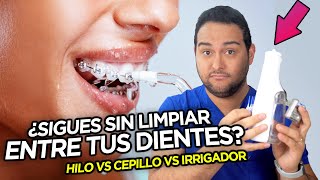 HILO DENTAL vs IRRIGADOR BUCAL vs CEPILLO INTERDENTAL ¿CUAL ES EL MEJOR 🔥🫣 ¡TE VAS A SORPRENDER [upl. by Herculie]