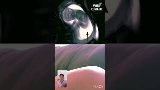 Baby Kicking in Womb Ultrasound  shorts shortvideos pregnancyweekbyweek wikihealth [upl. by Haggar]