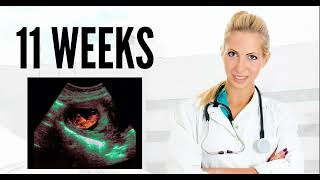 11 WEEKS ULTRASOUND 11 weeks pregnant ultrasound pregnancy ultrasound [upl. by Pozzy]