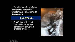 Atlantoaxial Rotary Instability Findings and Treatment Outcomes Research  Dr Fraser Henderson [upl. by Lim]