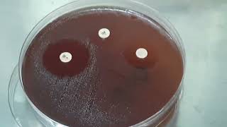 Antimicrobial Susceptibility Testing Result of Streptococcus agalactiae [upl. by Arabel]