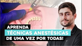 Guia Completo Técnicas Práticas de Anestesia em Odontologia [upl. by Reuven]