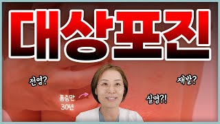 대상포진 환자들이 가장 많이 물어보는 7가지 [upl. by Iilek740]