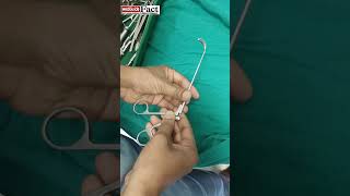 MAXILLARY ANTRUM GRASPING ROTATING FORCEPS  goviral shortfeed viralreels [upl. by Yruoc830]