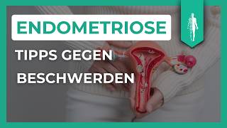 Pille Schmerzmittel amp Alternativen Die besten Tipps für Endometriose und Adenomyose [upl. by Nolyad]