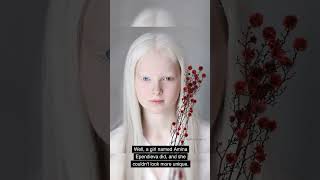 This Girl Has Both Albinism And Heterochromia shortvideo facts unique [upl. by Guthry]