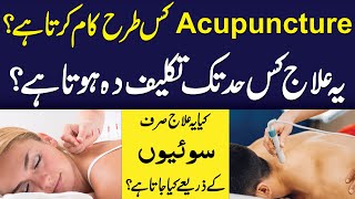 Acupuncture Kis Tara Kaam Karta Hai   Yeh Treatment Painful Hota Haii  Health And Nutrition [upl. by Aihtebat]