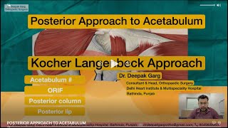 POSTERIOR APPROACH TO ACETABULUM  KOCHER LANGENBECK APPROACH  ACETABULAR FRACTURE  DR DEEPAK GARG [upl. by Dickinson]