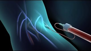 Blood Test for Cholesterol  Nucleus Health [upl. by Higbee29]