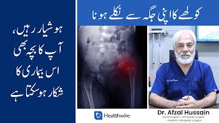 Developmental Dysplasia of Hip  DDH in Urdu Dr Afzal Hussain Orthopedic Surgeon [upl. by Ayekam]