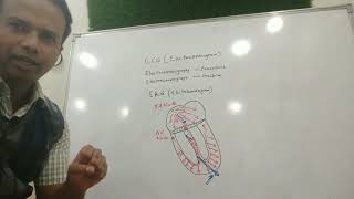 ECG made simple part 1  Basics Waves segment interval in Hindi [upl. by Malonis506]