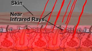 How Far Infrared Technology Works [upl. by Norabal]