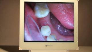 AG Neovo MedicalGrade Dental Display DR17 [upl. by Daveta]