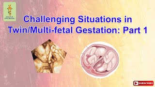 Challenging Situations in TwinMultifetal Gestation Part 1 [upl. by Winebaum]