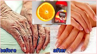 Orange natural beauty tips remove wrinkles from hands completely in 6 days Hand wrinkles home remedy [upl. by Catlin]