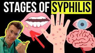 Doctor explains the Symptoms and Stages of SYPHILIS STI [upl. by Ravel]