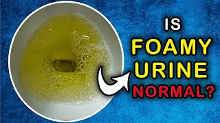 Is it NORMAL to have a FOAMY URINE Cause and Treatment [upl. by Ttnerb]