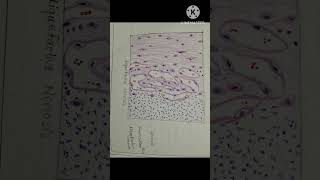 shortsshortsvideo youtubeshorts pathology cell death necrosis apoptosis 2nd year mbbs [upl. by Litnahs639]