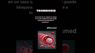 Triada de Virchow triadadewirchow viral viralvideos video medicina doctor quiz fyp parati [upl. by Eihpos]