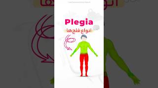 Let me explain different types of plegia 👨‍🦽 shorts medical neurology [upl. by Oinesra609]