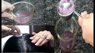 How To Use Onion Juice For Hair RegrowthDandruff Hair fall Control Premature Greying Of Hair [upl. by Acirretal862]