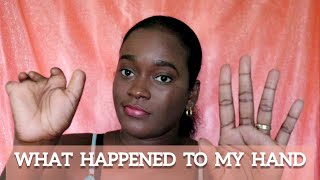 WHAT HAPPENED TO MY HAND  symbrachydactyly  Trinidad Vlogmas day 13 [upl. by Einimod]