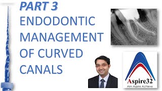 Endodontic management of curved canals  Part 3 [upl. by Indyc]