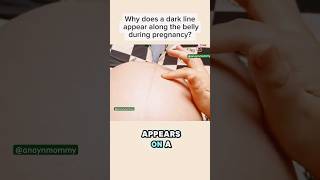 Why is there dark line on the belly during pregnancy momlife pregnancytips shorts viralvideo [upl. by Chisholm810]