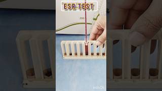 Esr westergren method  ESR test means  What does ESR lab test showlaboratory test bloodtest [upl. by Seditsira292]