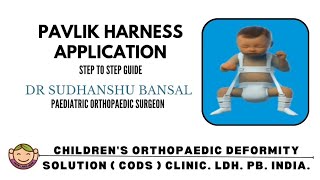 PAVLIK HARNESS application guide  Dr Sudhanshu Bansal  CODS CLINIC [upl. by Harned770]