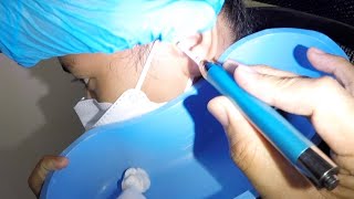 Removing Girls Earwax Using Lighted Ear Pick [upl. by Eiznikcm]