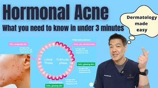 Hormonal acne explained in under 3 minutes  Dermatologist reviews [upl. by Nessie835]