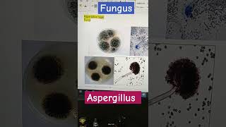 fungus  aspergillus niger  very important  very common fungus  microbiology  easily grow [upl. by Slosberg222]