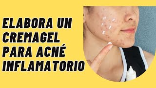 Cremagel antiacné con clindamicina e indometacina [upl. by Avin]