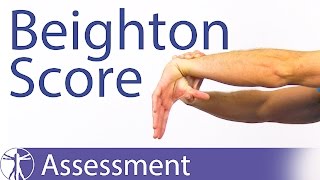 The Beighton Score  Generalized Joint Hypermobility Laxity [upl. by Adnahsat]