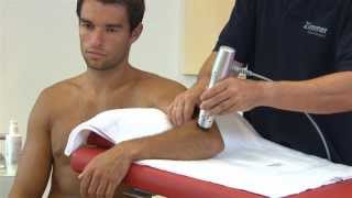 Radial Shockwave Therapy  Radial Pulse Therapy [upl. by Eceinej]