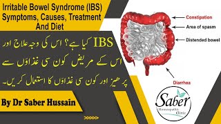 Irritable Bowel Syndrome IBS Symptoms Causes Treatment and Diet Urdu amp Hindi by Dr saber Hussain [upl. by Irt501]