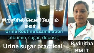 Urine Routine examination Urine sugar practical in Tamil [upl. by Aerb]