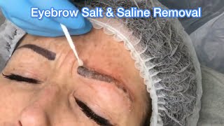 Eyebrow Tattoo Salt amp Saline Removal [upl. by Omolhs714]