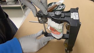 Mounting Casts on Articulator Using the Facebow Technique [upl. by Marilou]