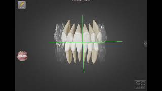 Basic concept of Tooth  Episod 01  Firoj Ahmed Fahim  MediVerse [upl. by Jak]