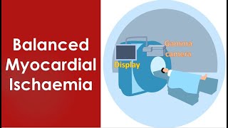 Balanced Myocardial Ischaemia [upl. by Burkle]