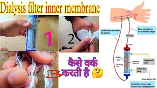 TYPES OF DIALYZER amp MEMBRANE DIALYZER INNER PART  डायलज़र और मेम्ब्रैंन के प्रकार और अंदर के परत🤔 [upl. by Kohn]