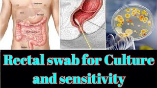 Rectal Swab for culture and sensitivity CS test UrduHindi [upl. by Inamik382]