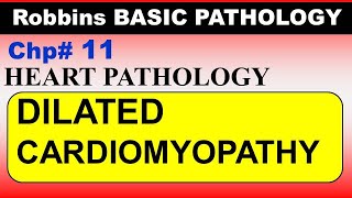 Chp11 Robbins Patho  Heart Pathology  DILATED Cardiomyopathy  Dr Asif Lectures [upl. by Giff]