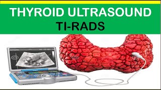 Thyroid Ultrasound TIRADS [upl. by Namolos]