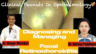 Toxoplasma RetinochoroiditisCase discussion for Ophthalmologists Residents trainees and students [upl. by Airoled403]